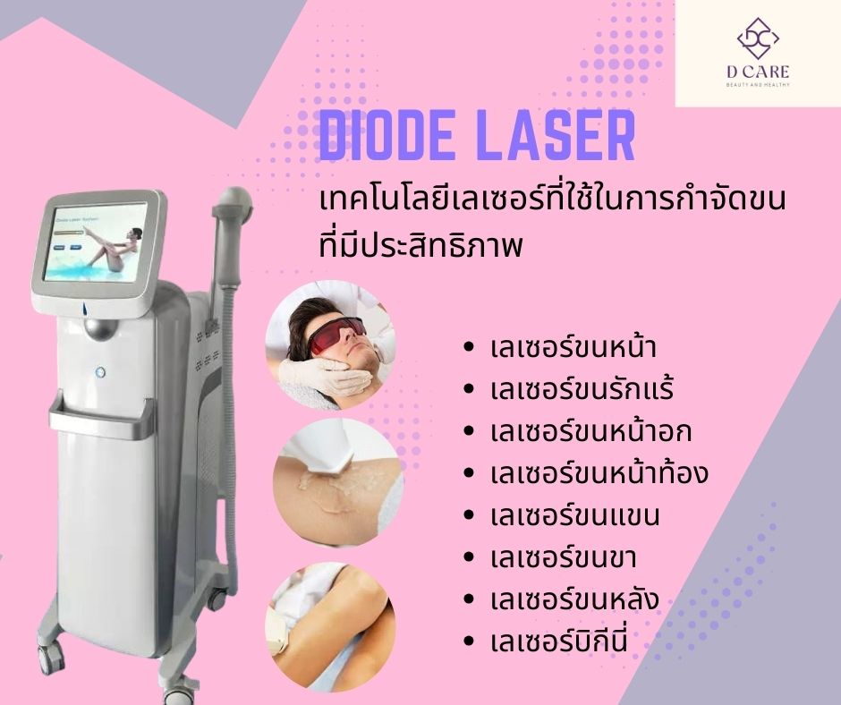 Diode Laser : กำจัดขน