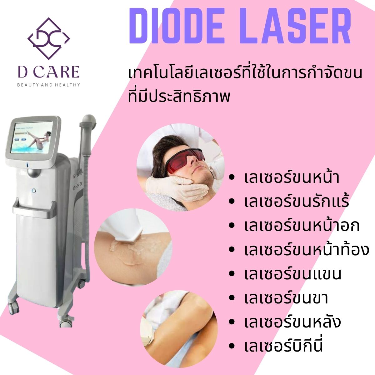 Diode Laser : กำจัดขน