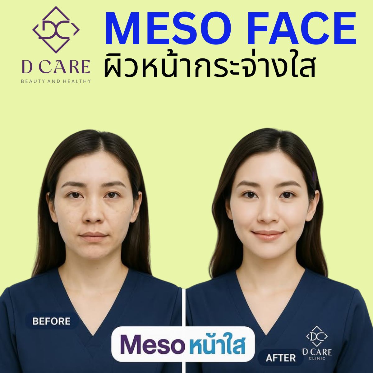 MESO FACE : 	ผิวหน้ากระจ่างใส 